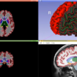 3D printed brain models for education and training